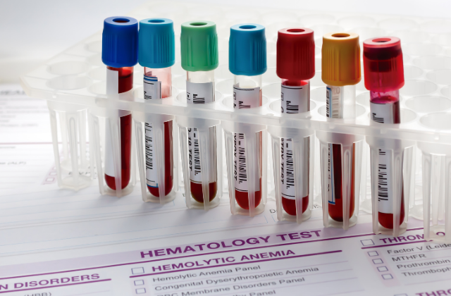 Vials used for blood-based biomarker testing.