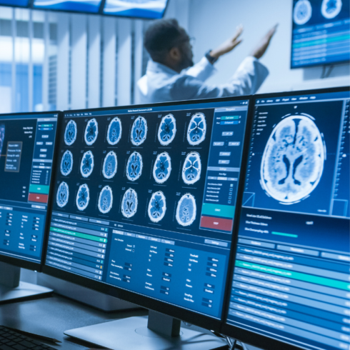 computer monitor showing brain scans